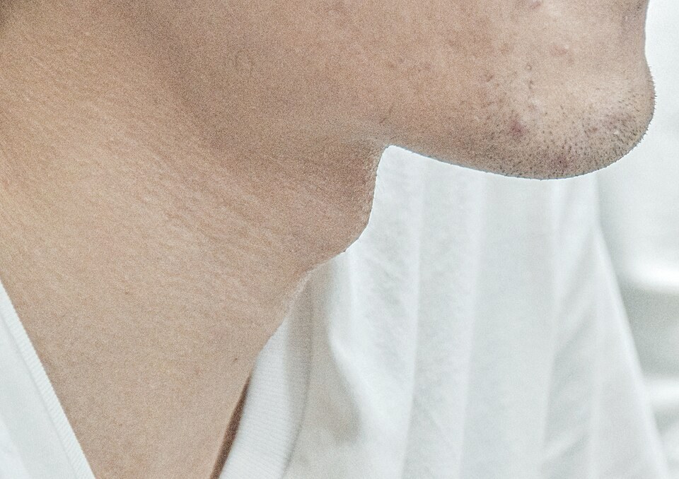 Side view of a man's neck and Adam's apple