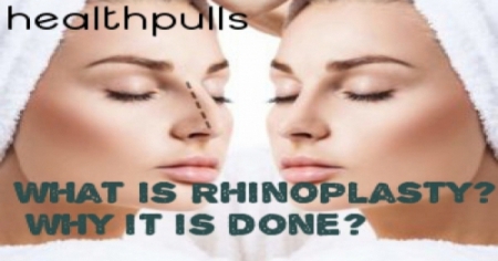 Rhinoplasty