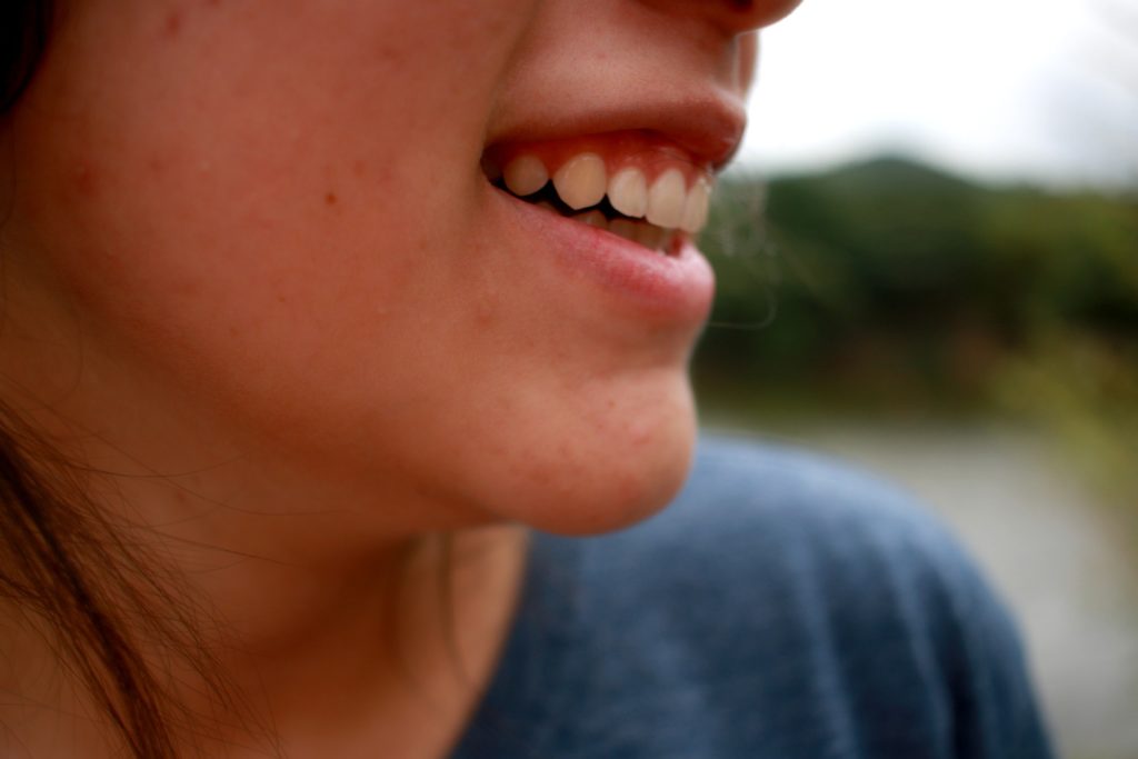 acne scars