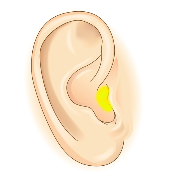 types of ear discharge