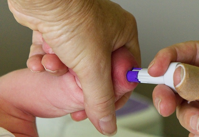 Baby with Low Blood Sugar