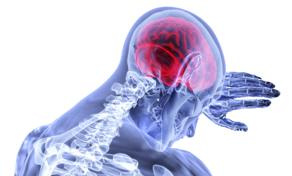 Embolic stroke