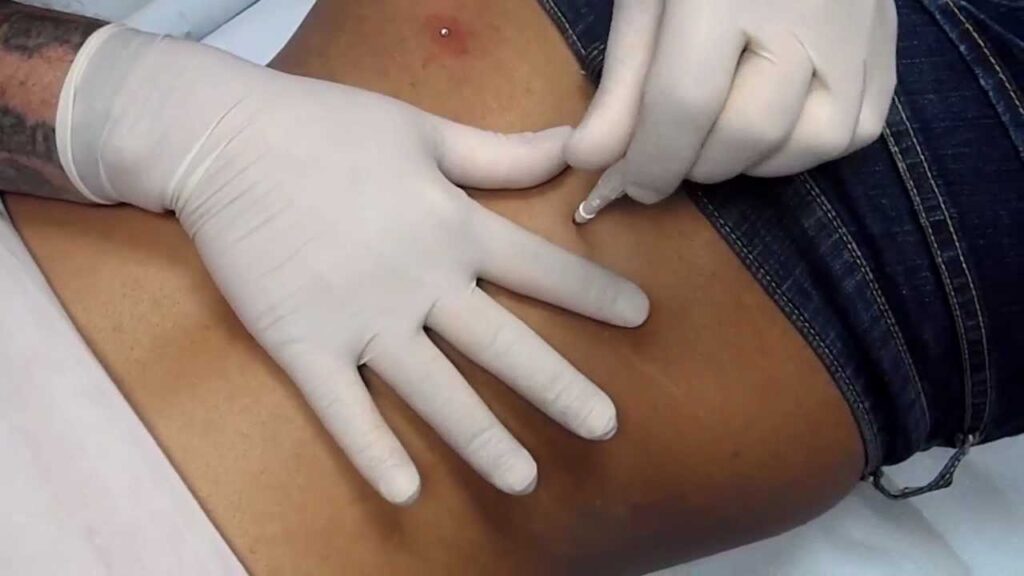 Back Piercing