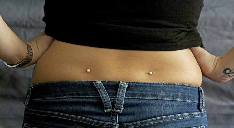 back dimples