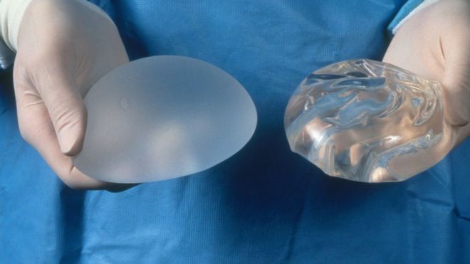 Butt Implants
