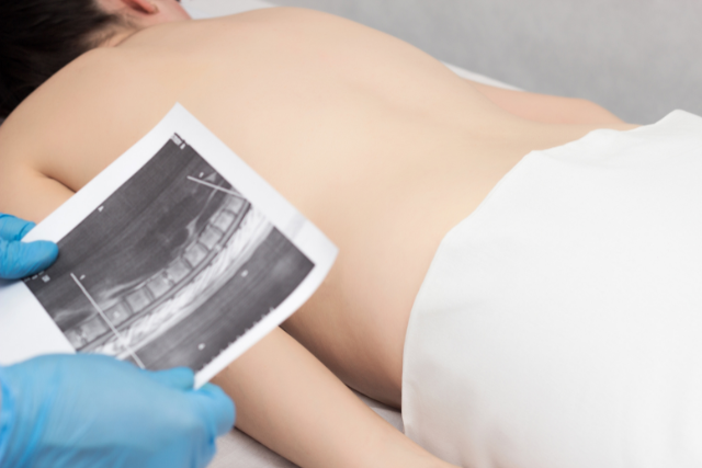 spine imaging