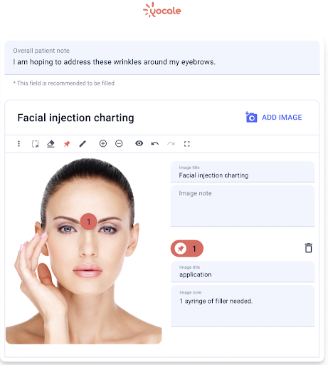 facial injection charting