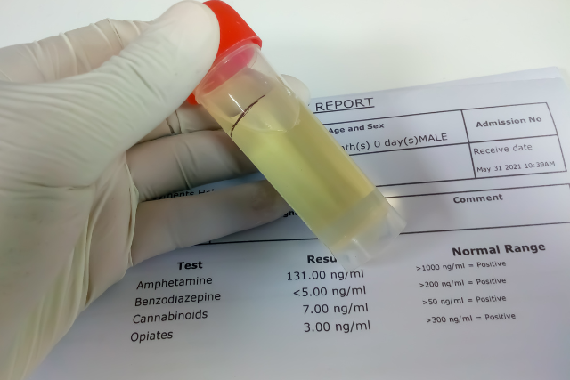 drug testing result